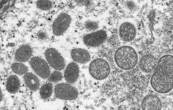 Sala de situação vai monitorar varíola dos macacos no país